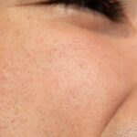 close-up-young-man-skin-texture_23-2149441244